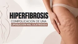 HIPERFIBROSIS CON LA DRA. NELYAM MEJÍAS DE LA HOZ  LA ONCE EN EL 14 | 3 SEPTIEMBRE 2026