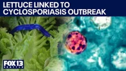 Health Watch: Lettuce found as Cyclosporiasis culprit | FOX 13 Seattle