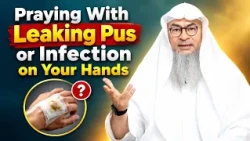 Praying With Leaking Pus or Infection on Your Hands | Sheikh Assim Al Hakeem #hudatv