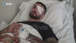 Rama kërcënon me dhunë ata që protestojnë, fajëson protestuesit për 28-vjeçarin e plagosur