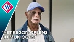 De huid van deze man veranderde opeens door vitiligo | Hoe gaat het?