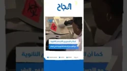 هل تخلص "دماء اللاما" البشرية من جائحة كورونا ؟