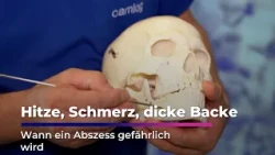 When toothaches become dangerous | Sachsen Fernsehen