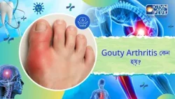 Gouty Arthritis কেন হয়। Health and Wellness