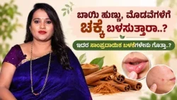 ಮೊಡವೆಗಳಿಗೆ ಚಕ್ಕೆ ಬಳಸುತ್ತಾರಾ..? ಇದರ ಸಾಂಪ್ರದಾಯಿಕ ಬಳಕೆಗಳೇನು ಗೊತ್ತಾ..? | MYTHS AND FACTS