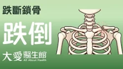 【大愛醫生館】 跌斷鎖骨 20260717