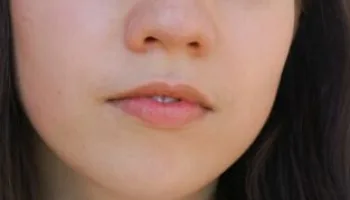 El curioso caso de Natalia Grace