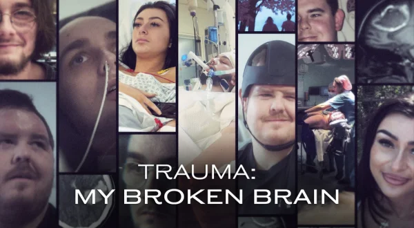 Trauma: My Broken Brain