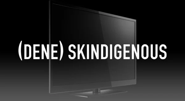 (Dene) Skindigenous