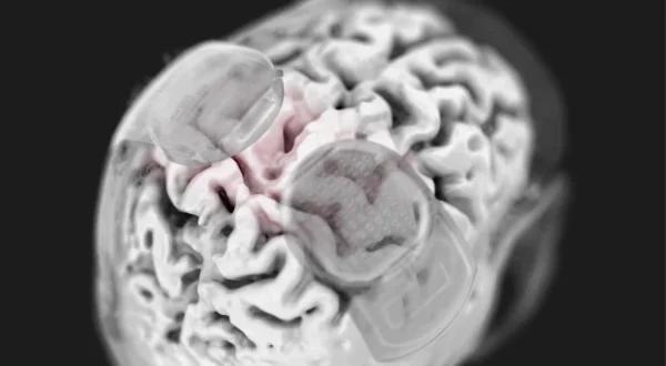 Brain-Computer-Interface: Das digitale Gehirn