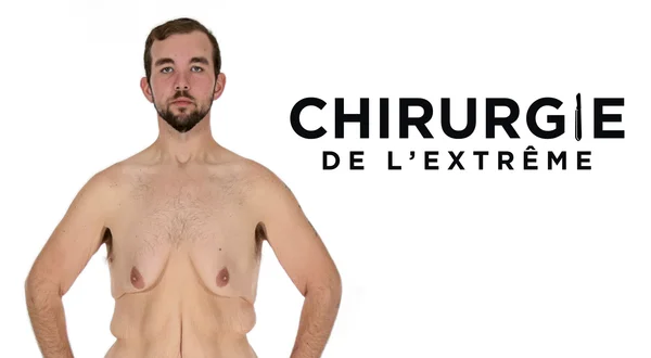 Chirurgie de l'extrême