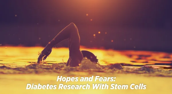 Hopes and Fears: Diabetes Research With Stem Cells