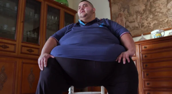 Mi vida con 300 kilos: Italia