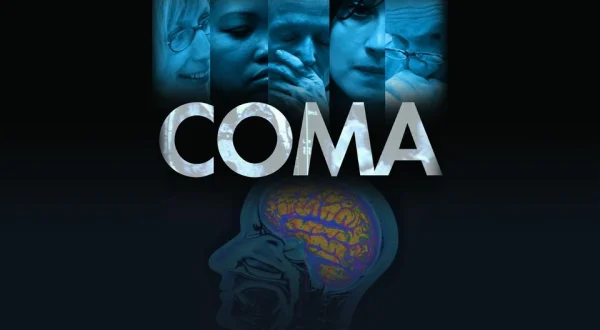 Coma