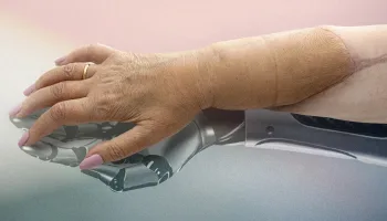 Die neue Hand – Geschichte einer Transplantation
