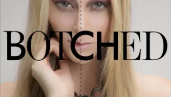 Botched