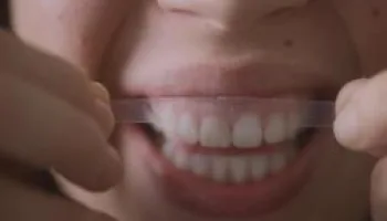 Des dents blanches... au rire jaune !