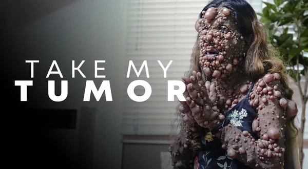 Take My Tumor